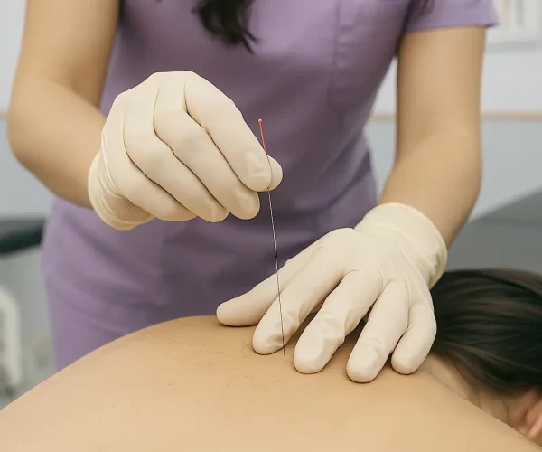 Lucía Egea Fisioterapeuta - Punción Seca - Enfoque